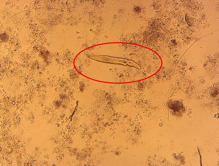 Chaetonotus