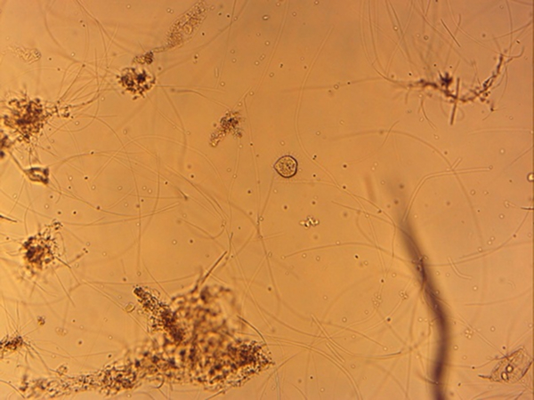 スフェロフィリア