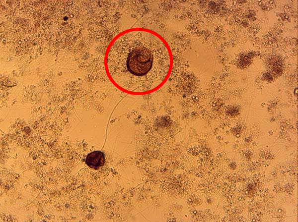 セントロピキシス